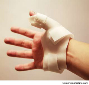 Deficits in grip and pinch strength as well as coordination can greatly limit a person’s ability to perform self-care and activities of daily living.