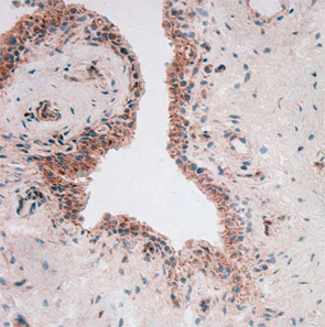 Figure 2: Visfatin in rheumatoid synovium.