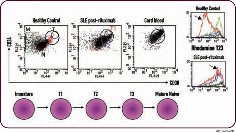 sle anecdotal report is b a key to autoimmune therapy article the sle anecdotal report is b a key to autoimmune therapy article the