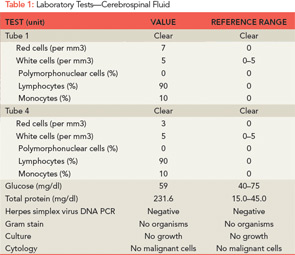 Systemic corticosteroids rheumatoid arthritis