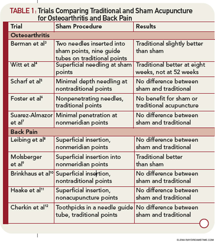 Is acupuncture helpful for relieving back pain?