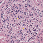 Figure 1: Hematoxylin & Eosin Staining