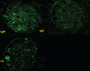 Figure 3: Immunofluorescence