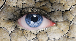 Sjögrens Syndrome: The Need to Bridge Patient Symptoms & Objective Findings