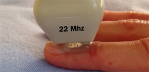 Figure 6: A high-frequency linear ultrasound probe (22 MHz) allows for very high-resolution imaging of superficial structures.