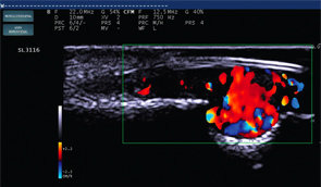 Figure 4: Color Doppler at the erosion site displays a 5 mm vascular lesion.