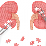 Rheumatoid Arthritis & Autoimmune Glomerulonephritis