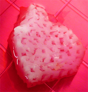 A 3D computer-aided design program was used to make a model of a jawbone segment that needed to be replaced. This image shows the tailor-made, bioprinted jawbone structure.