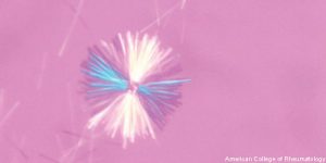 ACR_GoutCrystals_500x270