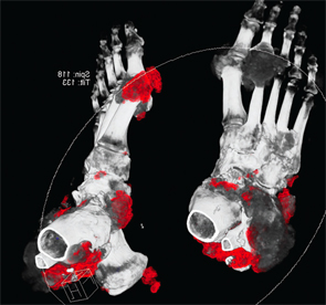 Figure 4: DECT of feet #1