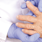Rheumatoid Arthritis Research Provides New Insights on Risk Factors, Identification Tools, Intervention