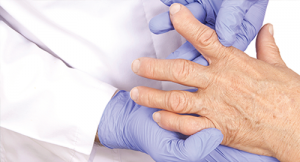 Rheumatoid Arthritis Research Provides New Insights on Risk Factors, Identification Tools, Intervention