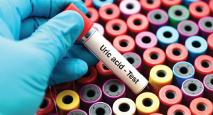 Diagnosis of Acute Gouty Arthritis Obscured by Anchoring Bias