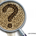 Osteoporosis Screening Is Underutilized Despite Recommendations