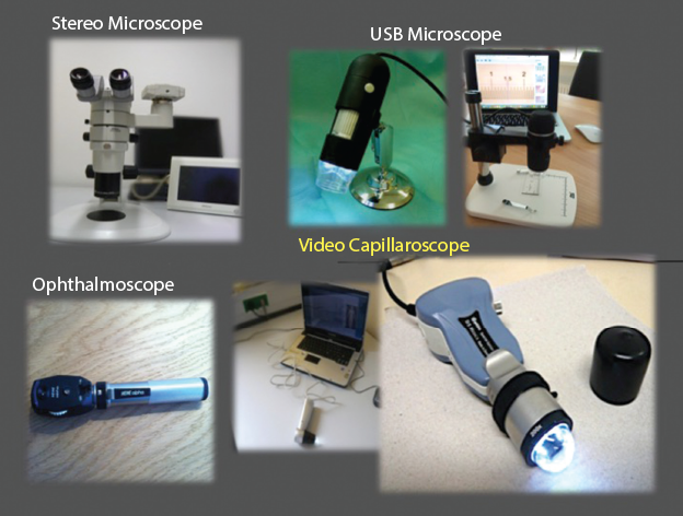 USB Digital Nailfold Capillaroscopy Blood Microcirculation Test Machine -  China Microcirculation Microscope, Capillary Microscope | Made-in-China.com