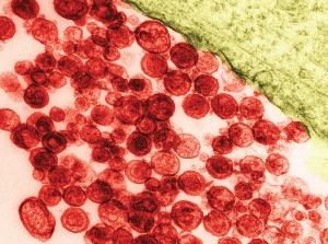 Particles of human T-lymphotropic virus 1 on a transmission electron micrograph. The virus has been implicated in lymphoma development.