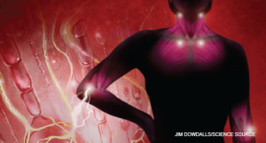Fibromyalgia-Related Sleep Disorder Diagnosis & Treament Tips