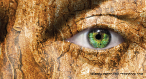 Diffuse Scleroderma: A 1991 Case Through the Lens of Today