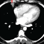 The Diagnostic View: Assess Your Rheumatology Knowledge