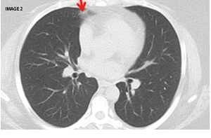 The Diagnostic View: Assess Your Rheumatology Knowledge