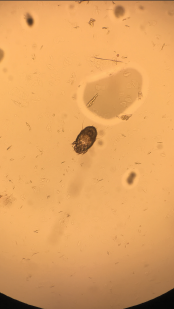 Image 4: A skin scraping turned up scabies.