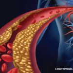 A Comprehensive Review of NSAID Cardiovascular Toxicity