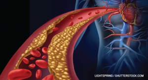 A Comprehensive Review of NSAID Cardiovascular Toxicity