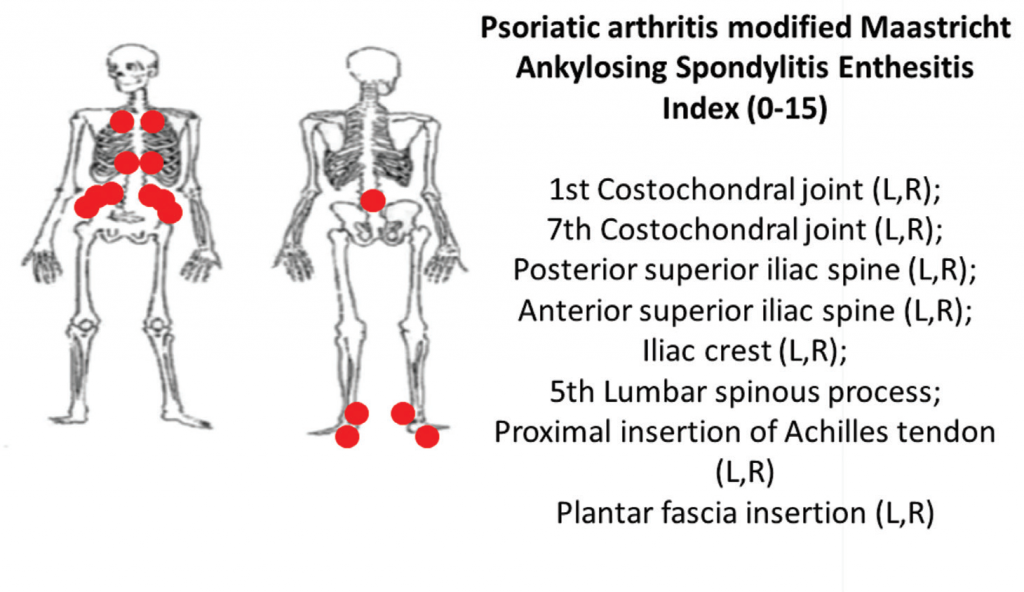 6B: The PsA-modified Maastricht Ankylosing Spondylitis clinical enthesitis index (PsA MASES).z
