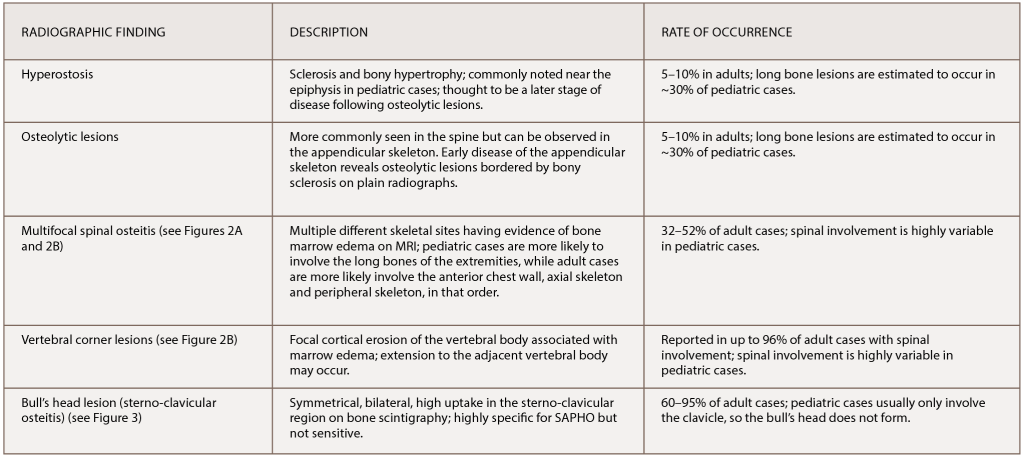 Table 1: The Most Common Radiographic Observations of SAPHO Syndrome 