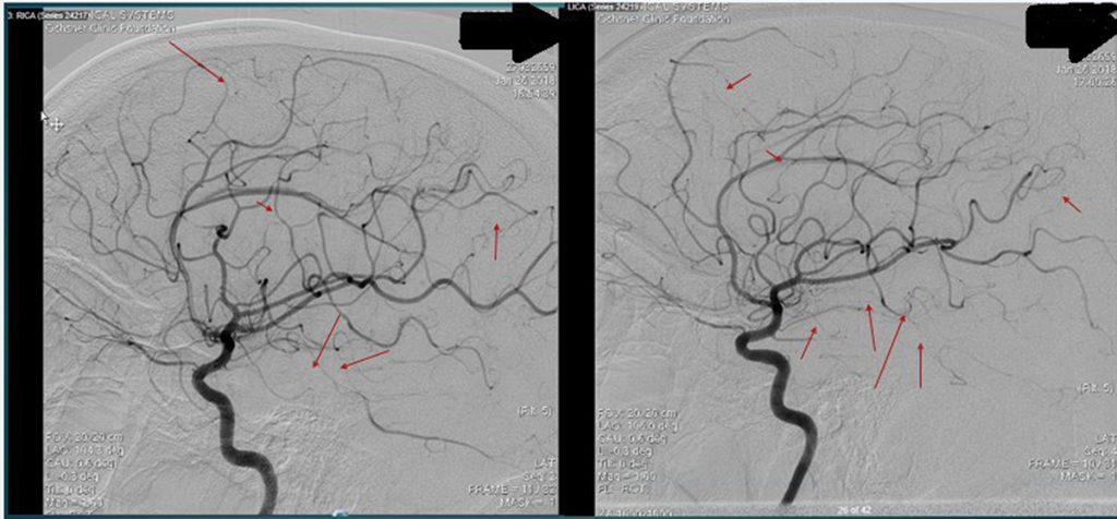 Figure 3 and Figure 4