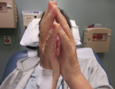 Figure 2. The prayer sign, which is rarely seen in patients suffering from eosinophilic fasciitis.