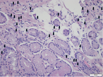 Foci of increased eosinophils (arrows) in superficial layers of the stomach (hematoxylin and eosin stain at 40X magnification).