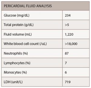 Table 1: Pericardial Fluid Analysis