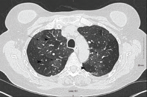 Figure 2a: Transverse Section