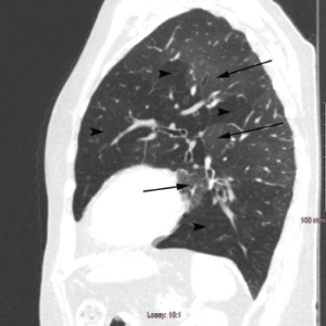 Figure 2b: Sagittal Section