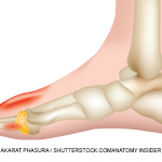 Akarat Phasura / shutterstock.com