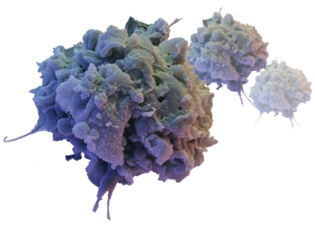 An activated macrophage.