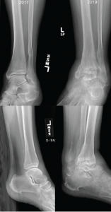 Figure 2: Comparison of X-rays