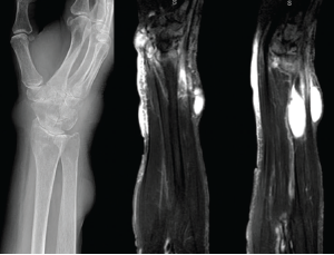 Figure 3: X-rays & MRI