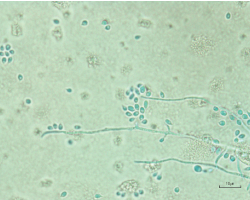 Light microscopy of aspirate culture showing Sporothrix schenckii species.