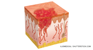 ilusmedical / shutterstock.com
