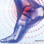 Standing on a Hidden Burden: The Oft-Overlooked Problem of Foot and Ankle Osteoarthritis