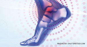 Standing on a Hidden Burden: The Oft-Overlooked Problem of Foot and Ankle Osteoarthritis