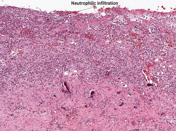 Figure 1A