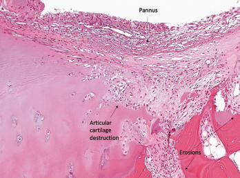 Figure 1B