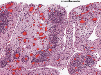 Figure 1C