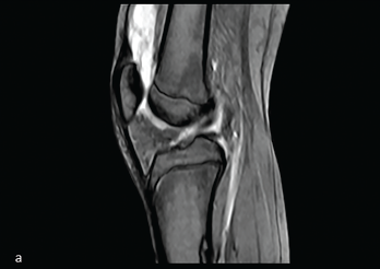 Figure 1: Midline Sagittal MRI