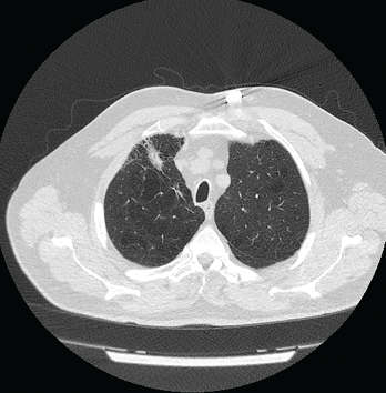 Figure 1: Computed Tomography