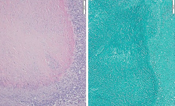 Figure 3: Hematoxylin & Eosin Stain, Low Power