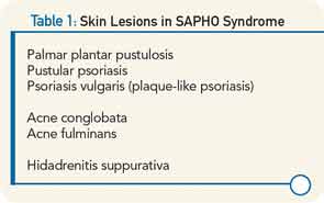 Skin Lesions in SAPHO Syndrome